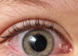 बच्चों की आंखों की दुश्मन हैं ये 3 चीजें, पुतली हो जाती है डैमेज, सर्जरी भी नहीं ला पाती रोशनी children eyes safety tips how to prevent eye injury