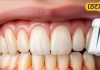 Dental Care: दांतों की सेहत के लिए जरूरी हैं ये विटामिन्स! डॉक्टर से जानें किन फलों से दूर होगी डेंटल प्रॉब्लम – Uttar Pradesh News