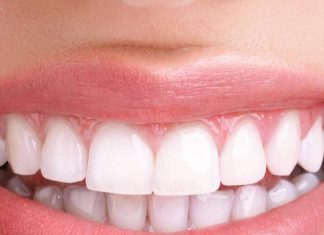 मरीजों को फ्री मिलेगा 50 हजार कीमत वाला डेंटल बोन ग्राफ्ट, दिल्ली के इस अस्पताल में खुली बैंक free dental bone graft in maulana azad dental college central tissue bank