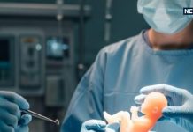 दिल्ली दंपति ने AIIMS को सबसे छोटा भ्रूण दान कर मानवता दिखाई