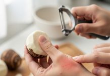 how to cut arbi without itching। घरेलू नुस्खे खुजली से बचाव के लिए