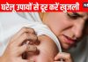 Khujli ka Gharelu Upay: इन 10 घरेलू उपायों से दूर करें खुजली