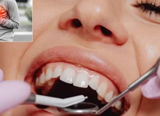 दुनिया के 3.7 अरब लोगों के मुंह में बीमारियां! दिल-किडनी पर मंडराया खतरा, डॉक्टरों ने दी वॉर्निंग oral disease can harm heart brain and kidney by iadr experts