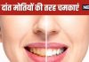 Home Remedies To Whiten Yellow Teeth Naturally at Home | पीले दांतों को बनाएं सफेद इन आसान घरेलू उपायों से