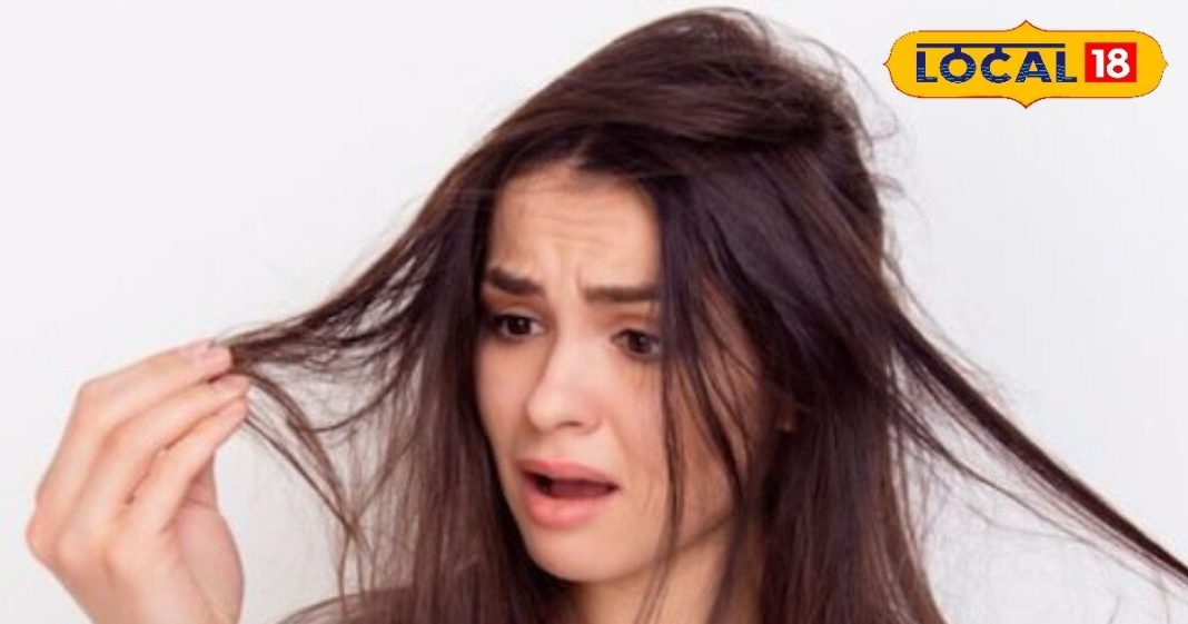 1760848311_HYP_5524722_cropped_18102025_164821_1663924364_hairproblems166_1-16x9.jpg