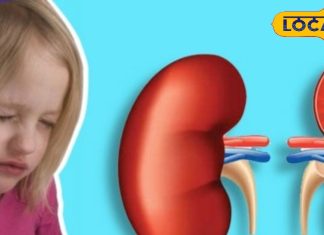 Health Tips : बच्चों में अगर दिखें ये 5 लक्षण… तो समझें मंडरा रहा किडनी पर खतरा! भूलकर भी न करें नजरंदाज – Uttar Pradesh News