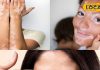 Vitiligo Treatment: सफेद दाग से हैं परेशान, तो भोपाल के वैध जी करेंगे जड़ी-बूटियों से इलाज..सिर्फ 10 दिन में दिखेगा असर