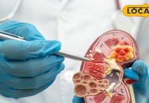 दिल्ली एनसीआर के टॉप किडनी विशेषज्ञ डॉक्टरों की सूची