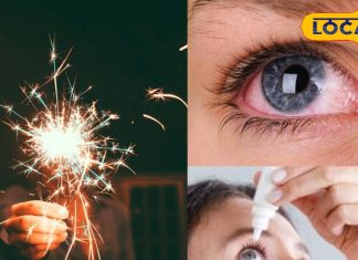 दीपावली पर पटाखों से आंखों की सुरक्षा जरूरी, अपनाएं ये असरदार टिप्स और अपने परिवार को रखें सुरक्षित