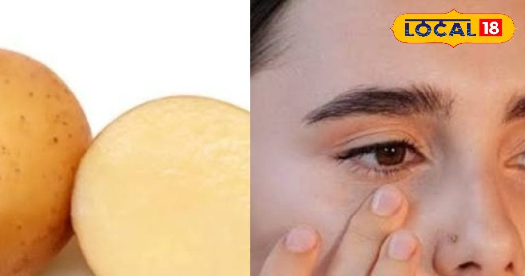 Beauty Tips: चेहरे पर हैं दाग-धब्बे या फिर हैं डार्क सर्कल से परेशान, बस रूई में डुबोकर लगा लें आलू का ये जादूई पैक और फिर देखें कमाल