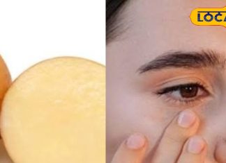 Beauty Tips: चेहरे पर हैं दाग-धब्बे या फिर हैं डार्क सर्कल से परेशान, बस रूई में डुबोकर लगा लें आलू का ये जादूई पैक और फिर देखें कमाल