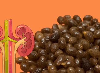 Papaya Seeds Can Remove Kidney Stones। पपीता बीज से किडनी स्टोन और यूरिन समस्या में प्राकृतिक राहत