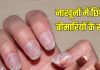 How your nails hidden many disease| आपके नाखूनों में छुपे होते हैं कई बीमारियों के राज