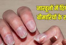 How your nails hidden many disease| आपके नाखूनों में छुपे होते हैं कई बीमारियों के राज