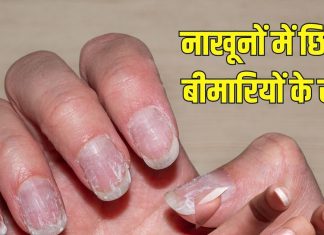 How your nails hidden many disease| आपके नाखूनों में छुपे होते हैं कई बीमारियों के राज