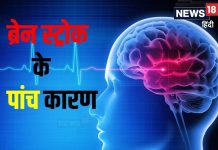 ब्रेन स्ट्रोक के ये हैं 5 बड़े कारण, एक को भी किया कंट्रोल तो 40% घटेगा रिस्क, डॉ. सुनील – Bharat.one हिंदी