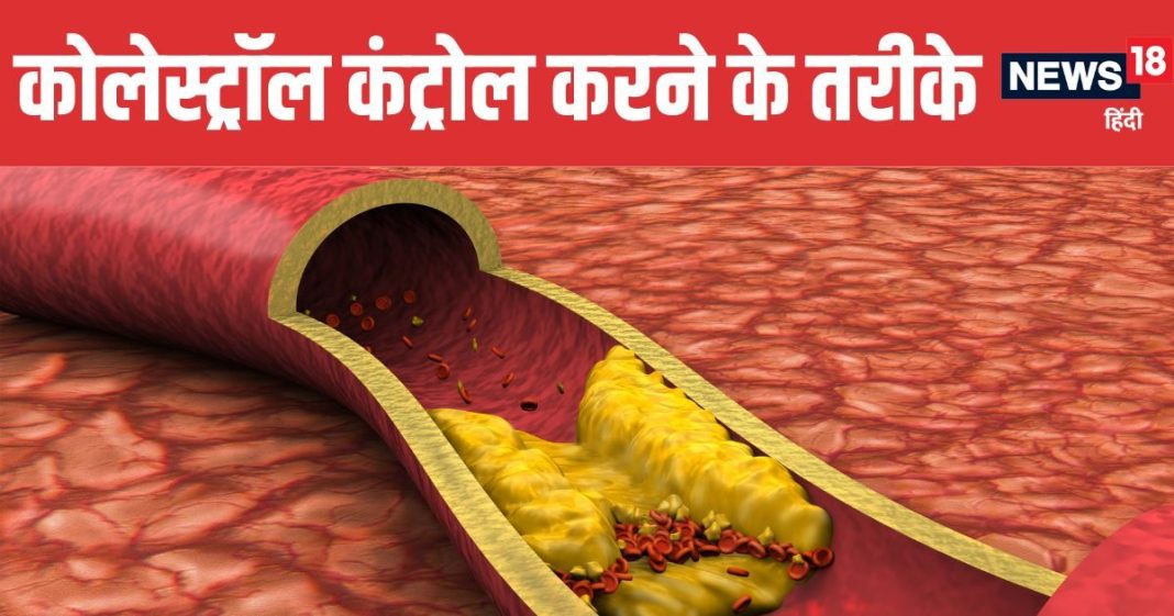 cholesterol-control-tips-2025-10-9a3af9fabd7d8a3e4a96c054a44e0fce-16x9.jpg