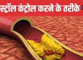 5 Natural Ways to Control High Cholesterol | हाई कोलेस्ट्रॉल को कंट्रोल करने के 5 नेचुरल तरीके