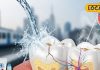 Dental Care: सेंसिटिव टूथपेस्ट से भी ज्यादा कारगर हैं ये 3 घरेलू नुस्खे! दांतों की झनझनाहट होगी गायब – Uttar Pradesh News