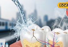 Dental Care: सेंसिटिव टूथपेस्ट से भी ज्यादा कारगर हैं ये 3 घरेलू नुस्खे! दांतों की झनझनाहट होगी गायब – Uttar Pradesh News