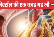 22 Year Old Woman Undergoes Heart Bypass Due to Genetic Disorder in Mumbai | 22 साल की युवती के हार्ट के तीनों आर्टरीज हुईं ब्लॉक | फैमिलियल हाइपरकोलेस्ट्रोलेमिया क्या बीमारी है