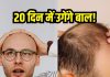 Hair growth in just 20 days on bald scalp: National Taiwan University का नया हेयर सीरम 20 दिन में उगाए नए बाल.