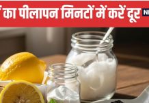 5 Effective Home Remedies to Whiten Teeth At Home | दांतों का पीलापन दूर करने के 5 घरेलू नुस्खे