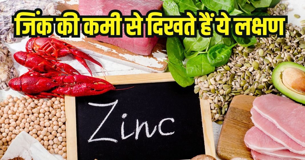 zinc-food-sources-2025-10-5660d658a4fd2bf3f561c538ebf269e8-16x9.jpg