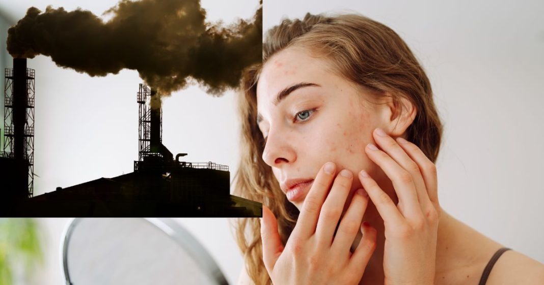 how to protect your skin | पॉल्यूशन से स्किन को कैसे बचाएं