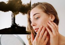 how to protect your skin | पॉल्यूशन से स्किन को कैसे बचाएं