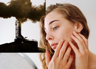 how to protect your skin | पॉल्यूशन से स्किन को कैसे बचाएं