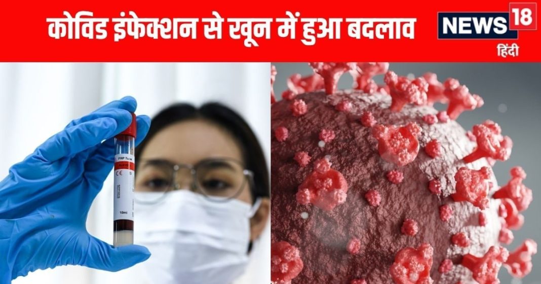 लॉन्ग कोविड के लक्षणों पर नई रिसर्च: माइक्रोक्लॉट्स का असर