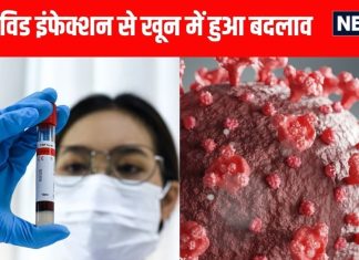 लॉन्ग कोविड के लक्षणों पर नई रिसर्च: माइक्रोक्लॉट्स का असर