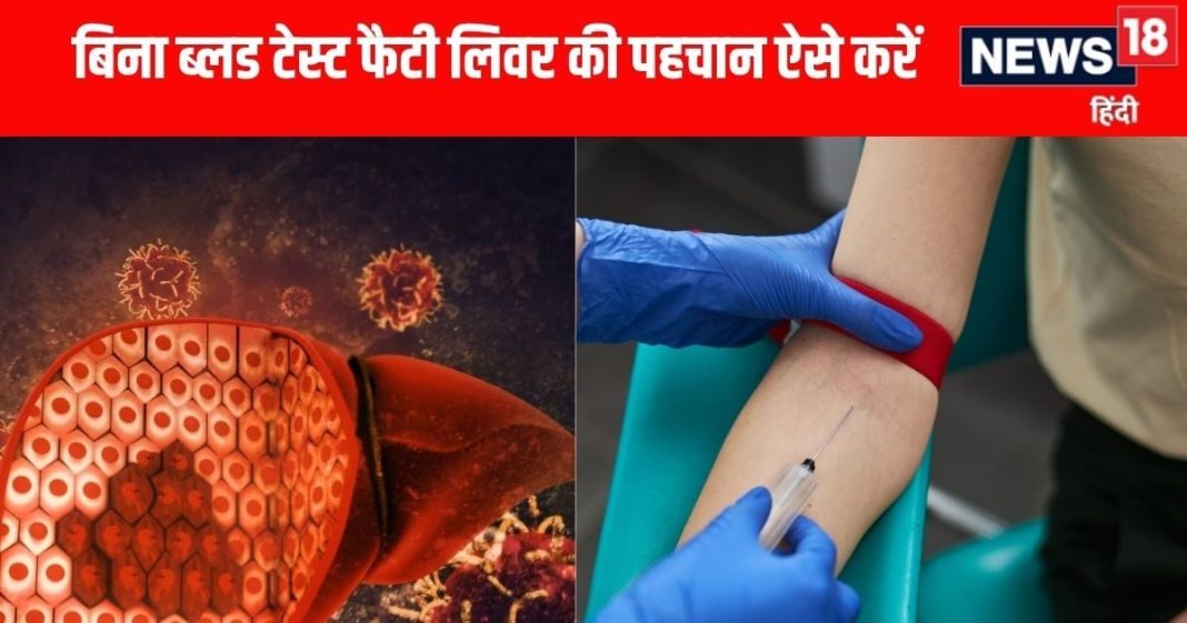 फैटी लिवर और इंसुलिन प्रतिरोध के शुरुआती लक्षण जानें