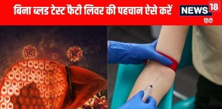 फैटी लिवर और इंसुलिन प्रतिरोध के शुरुआती लक्षण जानें