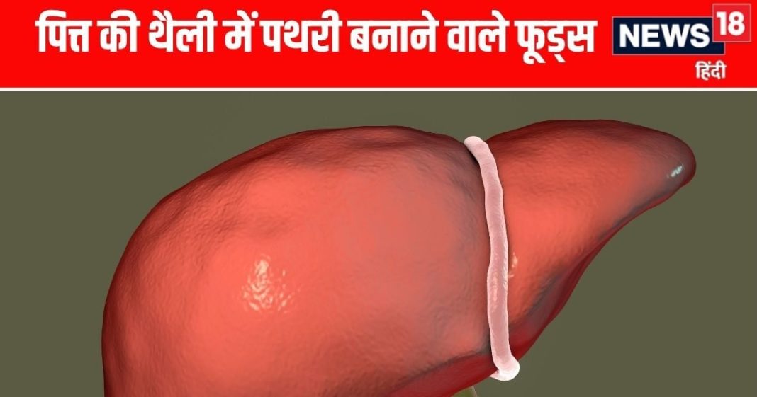 पित्ताशय में पथरी से बचने के लिए इन 4 फूड्स का सेवन कम करें.