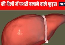 पित्ताशय में पथरी से बचने के लिए इन 4 फूड्स का सेवन कम करें.