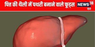 पित्ताशय में पथरी से बचने के लिए इन 4 फूड्स का सेवन कम करें.