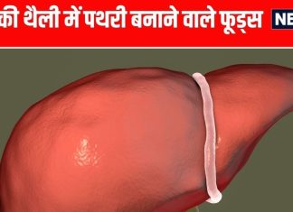 पित्ताशय में पथरी से बचने के लिए इन 4 फूड्स का सेवन कम करें.