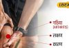 गठिया-जोड़ों के दर्द से हैं परेशान, तो अपनाएं ये उपाय, मिल जाएगी राहत, डाॅक्टर से जानिए इलाज और कारण