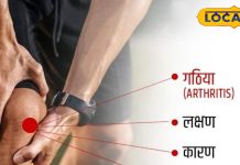 गठिया-जोड़ों के दर्द से हैं परेशान, तो अपनाएं ये उपाय, मिल जाएगी राहत, डाॅक्टर से जानिए इलाज और कारण
