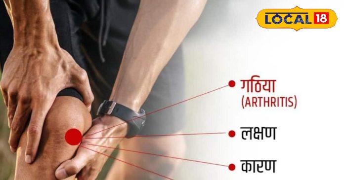 HYP_5554427_cropped_01112025_190306_arthritis_watermark_011120_2-16x9.jpg
