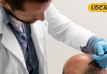 Delhi Top 8 Hair Transplant Doctors: दिल्ली के ये हैं टॉप 8 हेयर ट्रांसप्लांट डाक्टर, सहवाग समेत बदली है हजारों की जिंदगी