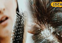 सर्दियों में बालों को हेल्दी रखना सबसे बड़ी चुनौती, डैंड्रफ और रूखेपन का करें घर बैठे इलाज – Madhya Pradesh News