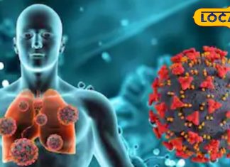 RSV virus threat in Delhi NCR serious impact on children