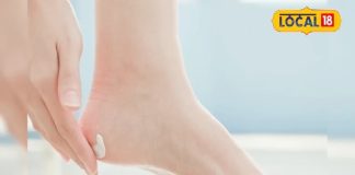 Nidhi Chaudhary home remedies tips for cracked heels