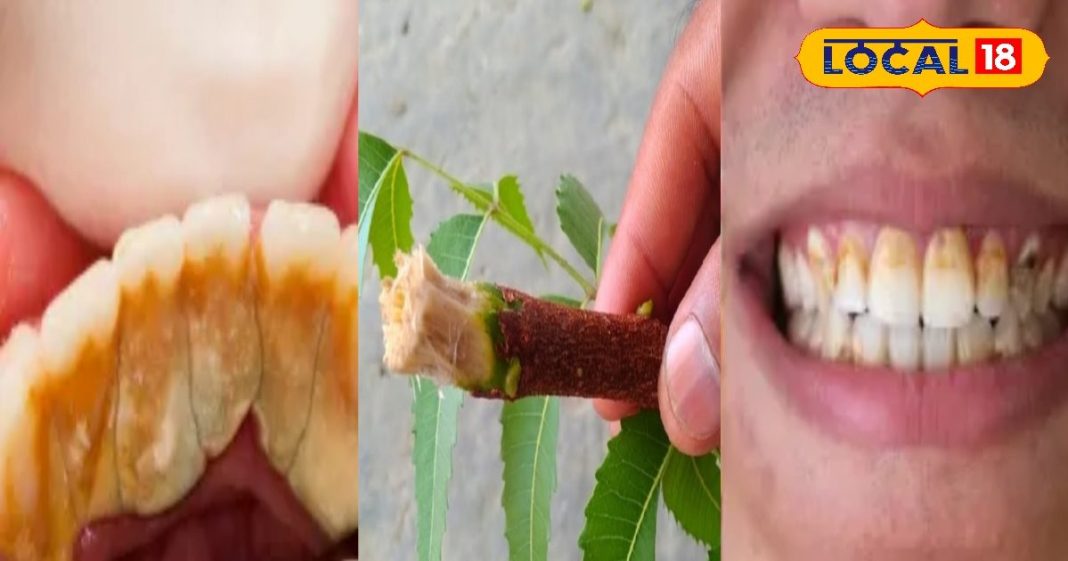 दांतों का पीलापन, कैविटी और बदबू बढ़ा रही परेशानी? आजमाएं ये आसान घरेलू नुस्खे, साइड इफेक्ट का भी डर नहीं – Rajasthan News
