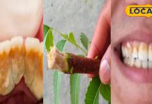 दांतों का पीलापन, कैविटी और बदबू बढ़ा रही परेशानी? आजमाएं ये आसान घरेलू नुस्खे, साइड इफेक्ट का भी डर नहीं – Rajasthan News