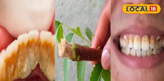 दांतों का पीलापन, कैविटी और बदबू बढ़ा रही परेशानी? आजमाएं ये आसान घरेलू नुस्खे, साइड इफेक्ट का भी डर नहीं – Rajasthan News