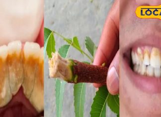 दांतों का पीलापन, कैविटी और बदबू बढ़ा रही परेशानी? आजमाएं ये आसान घरेलू नुस्खे, साइड इफेक्ट का भी डर नहीं – Rajasthan News